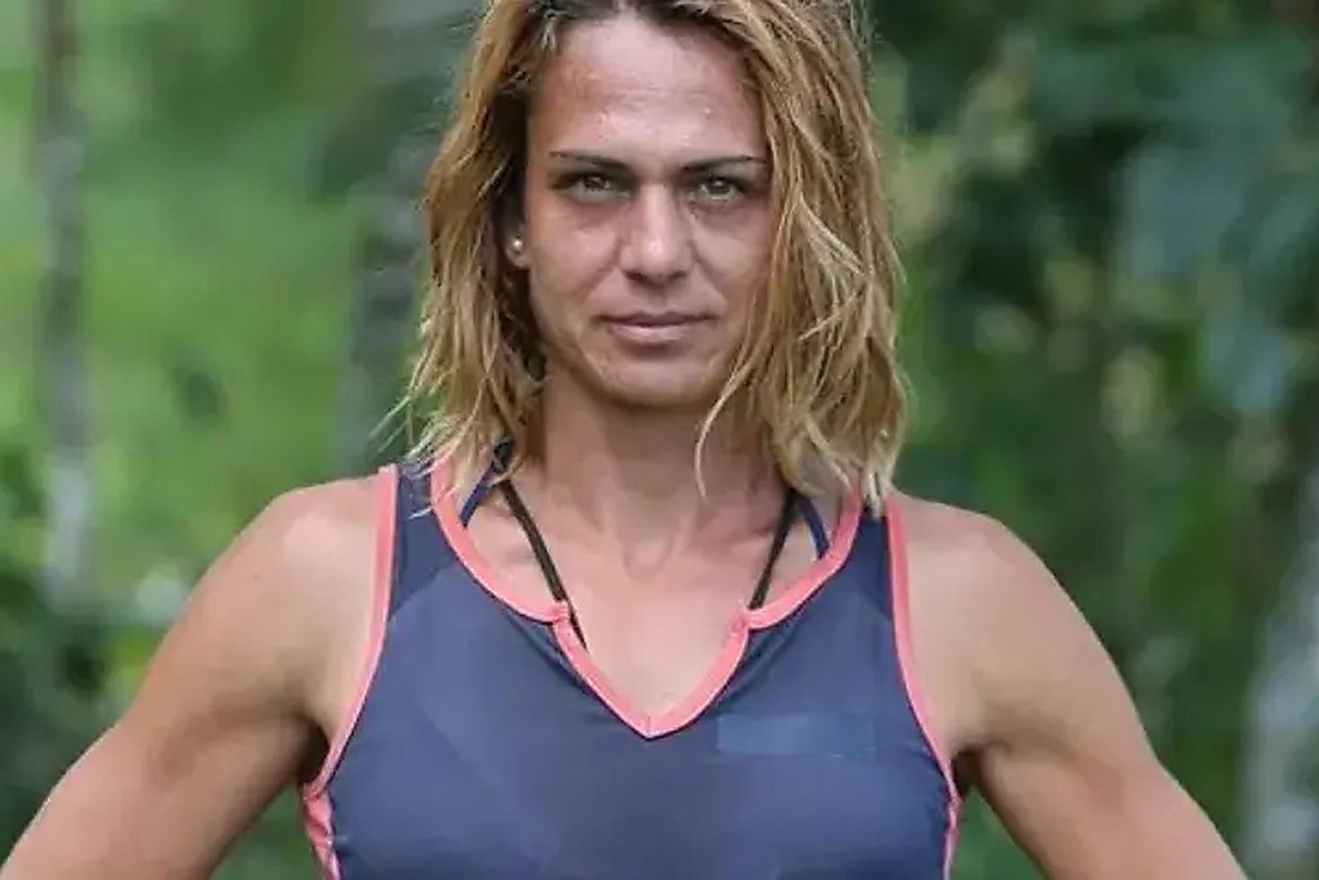 Estetik sonrası paylaşım! Survivor Nagihan Karadere’nin son hali