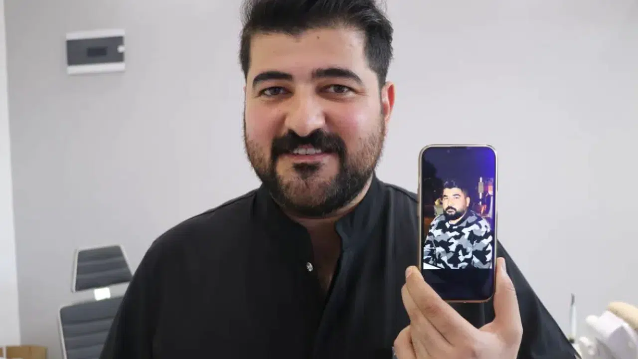 Sivas’ta Eypio’ya Benzeyen Diş Hekimi İlgi Odağı Oldu