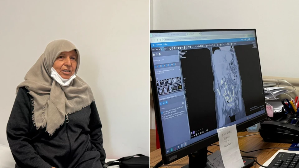 Aylar süren karın ağrısının altından 30 santimetrelik tümör çıktı: Yumurtalık kanseri | Sağlık Haberleri